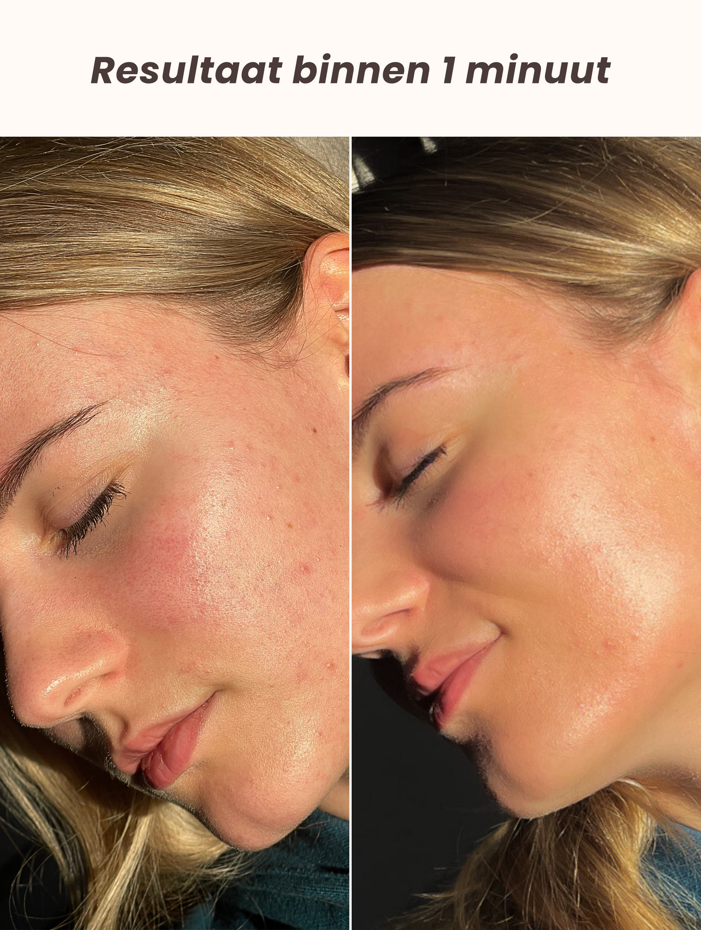 Tinted UV-barrier SPF 30