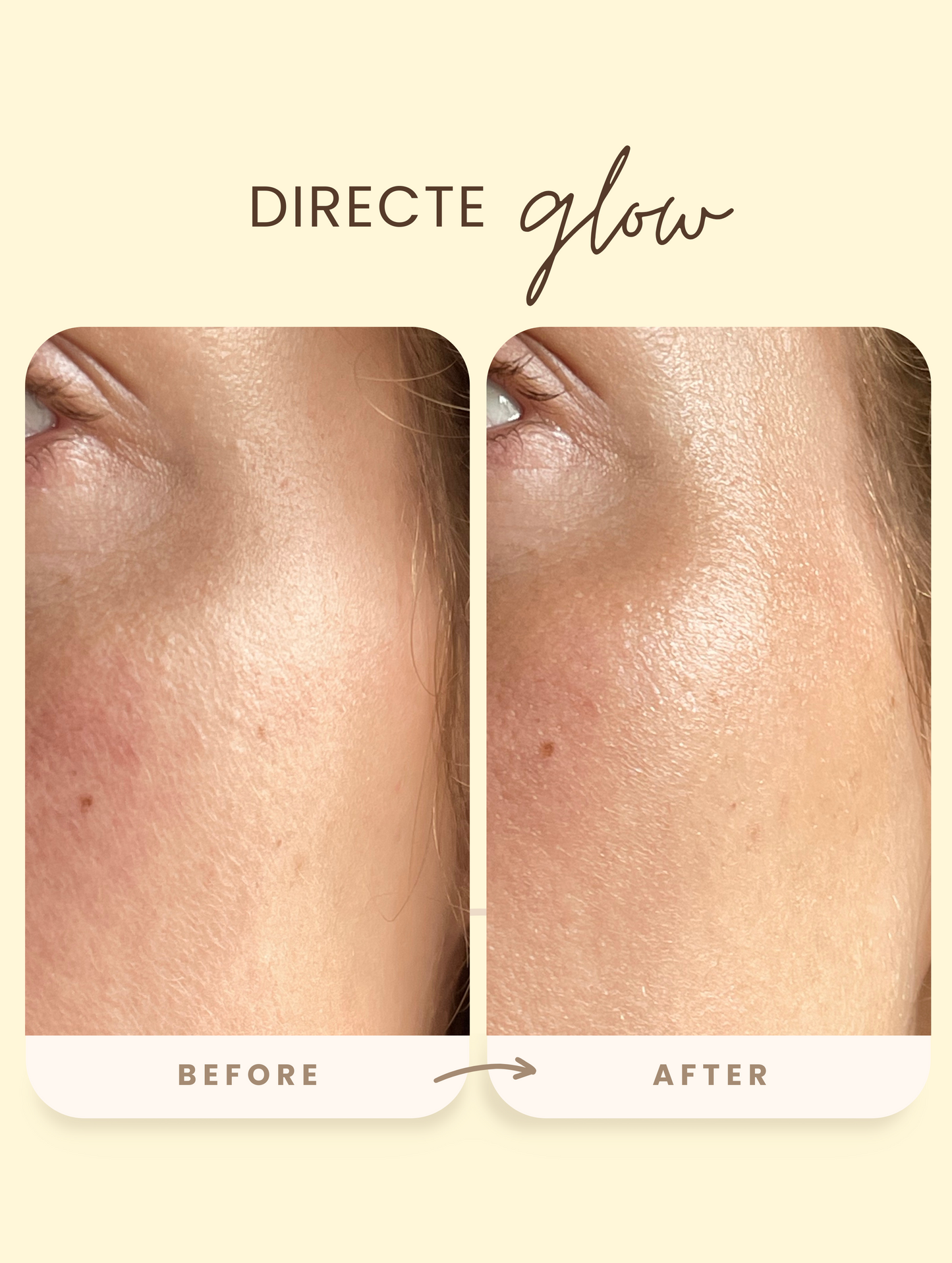 Vitamin C Booster | Voor een natuurlijke glow