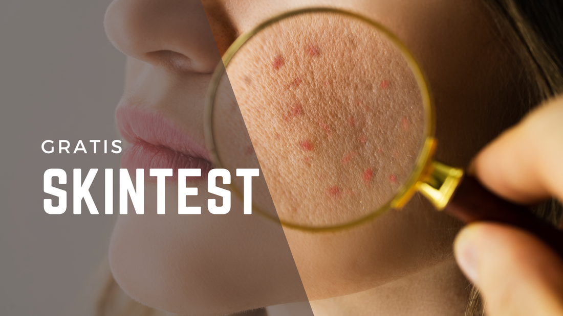 Ontdek jouw huidtype met de gratis SkinTest van SkinSecure