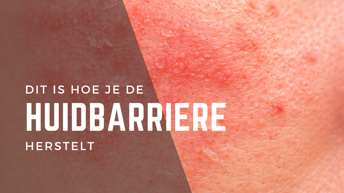 Beschadigde huidbarrière herstellen: tips en advies van huidtherapeut